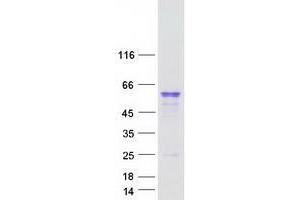 Validation with Western Blot