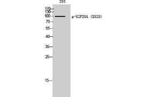 Western Blotting (WB) image for anti-Kinesin Family Member 20A (KIF20A) (pSer528) antibody (ABIN3182270)