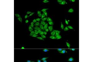 Immunofluorescence analysis of HeLa cells using PICK1 Polyclonal Antibody (PICK1 anticorps)