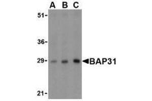 Western blot analysis of BAP31 in rat lung tissue lysate with AP30124PU-N BAP31 antibody at (A) 0. (BCAP31 anticorps  (Intermediate Domain))