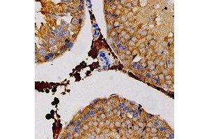 Immunohistochemical analysis of Carbonic Anhydrase 3 staining in human testis formalin fixed paraffin embedded tissue section.