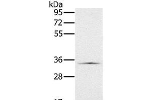 Western Blot analysis of Hela cell using NDUFA9 Polyclonal Antibody at dilution of 1:400 (NDUFA9 anticorps)