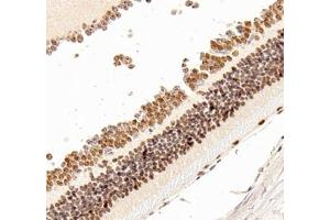 Immunohistochemistry of paraffin embedded mouse eye using OTX2 (ABIN7074952) at dilution of 1:600 (400x lens)