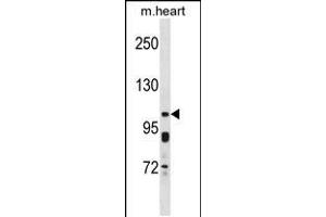 Western blot analysis in mouse heart tissue lysates (35ug/lane). (KCNQ5 anticorps  (C-Term))