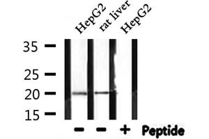 Western blot analysis of extracts from HepG2 and rat liver, using RPL27A Antibody. (RPL27A anticorps  (C-Term))