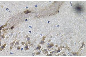 Immunohistochemistry of paraffin-embedded Mouse brain using NTRK1 Polyclonal Antibody at dilution of 1:100 (40x lens). (TRKA anticorps)