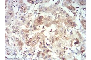 Immunohistochemistry (IHC) image for anti-PR Domain Containing 4 (PRDM4) (AA 476-575) antibody (ABIN5874480) (PRDM4 anticorps  (AA 476-575))
