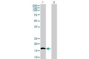 Lane 1: IL15 transfected lysate ( 17.