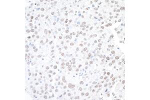 Immunohistochemistry (IHC) image for anti-Actin-Like 6A (BAF53A) (AA 25-75) antibody (ABIN7453898)