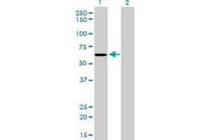 Western Blot analysis of NDOR1 expression in transfected 293T cell line by NDOR1 monoclonal antibody (M01), clone 3A11.
