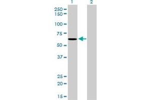 Western Blot analysis of NDOR1 expression in transfected 293T cell line by NDOR1 monoclonal antibody (M01), clone 3A11. (NDOR1 anticorps  (AA 498-595))