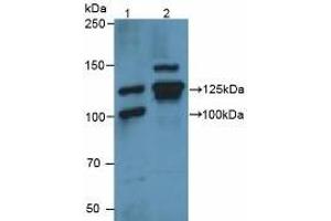 Figure. (Vinculin anticorps  (AA 1020-1134))