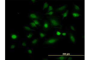 Immunofluorescence of monoclonal antibody to STAT5B on HeLa cell. (STAT5B anticorps  (AA 678-787))