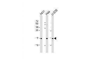 Western Blot at 1:2000 dilution Lane 1: A431 whole cell lysate Lane 2: Hela whole cell lysate Lane 3: U-2OS whole cell lysate Lysates/proteins at 20 ug per lane. (RPLP1 anticorps  (AA 18-49))