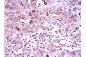 Immunohistochemistry (IHC) image for anti-ATP Citrate Lyase (ACLY) (AA 306-502) antibody (ABIN1842880)