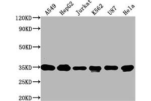 Western Blot Positive WB detected in: A549 whole cell lysate, HepG2 whole cell lysate, Jurkat whole cell lysate, K562 whole cell lysate, U87 whole cell lysate, Hela whole cell lysate All lanes: SUMF2 antibody at 1:2000 Secondary Goat polyclonal to rabbit IgG at 1/50000 dilution Predicted band size: 34, 25, 38, 24, 35 kDa Observed band size: 34 kDa (SUMF2 anticorps  (AA 26-301))