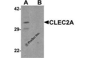 Western Blotting (WB) image for anti-C-Type Lectin Domain Family 2, Member A (CLEC2A) (N-Term) antibody (ABIN1031323) (CLEC2A anticorps  (N-Term))