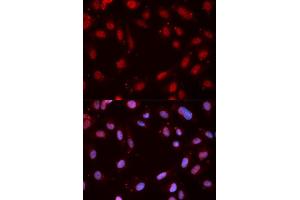 Immunofluorescence analysis of MCF-7 cells using Phospho-CHEK1-S280 antibody (ABIN5969878). (CHEK1 anticorps  (pSer280))