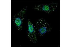 Fluorescent image of Chloroquine treated U251 cells stained with ATG7 antibody at 1:200.