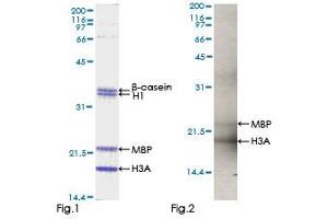 Kinase Activity Assay (KAA) image for Nemo-Like Kinase (NLK) (AA 1-515) protein (GST tag) (ABIN1312656)