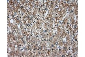 Immunohistochemical staining of paraffin-embedded liver tissue using anti-BTK mouse monoclonal antibody. (BTK anticorps)