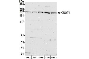 Western Blotting (WB) image for anti-CCR4-NOT Transcription Complex, Subunit 1 (CNOT1) (AA 1400-1450) antibody (ABIN7452794)