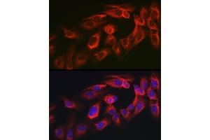 Immunofluorescence analysis of U2OS cells using MYO10 antibody (ABIN6128319, ABIN6144271, ABIN6144274 and ABIN6216113) at dilution of 1:350. (Myosin X anticorps  (AA 845-944))