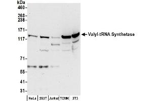 Western Blotting (WB) image for anti-Valyl-tRNA Synthetase (VARS) (AA 1214-1264) antibody (ABIN7450888)