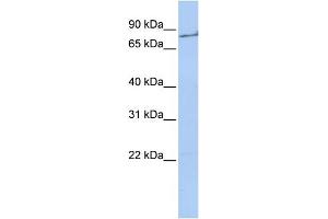 WB Suggested Anti-F2 Antibody  Titration: 1 ug/ml Positive Control: 721_B cell lysate (Prothrombin anticorps  (Middle Region))