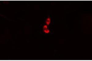 ABIN6274976 staining HepG2 cells by IF/ICC.