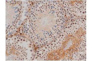 ABIN6267411 at 1/200 staining Mouse testis tissue sections by IHC-P.