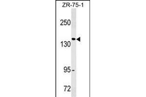 ITGAX/CD11c Antibody (N-term) (ABIN1538743 and ABIN2843834) western blot analysis in ZR-75-1 cell line lysates (35 μg/lane). (CD11c anticorps  (N-Term))
