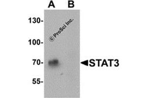 Western Blotting (WB) image for anti-Signal Transducer and Activator of Transcription 3 (Acute-Phase Response Factor) (STAT3) (N-Term) antibody (ABIN1077432) (STAT3 anticorps  (N-Term))