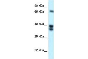 WB Suggested Anti-SH3BP1 Antibody Titration: 1. (SH3BP1 anticorps  (N-Term))