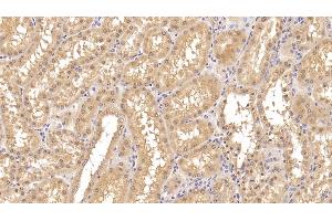 Detection of INSR in Human Kidney Tissue using Monoclonal Antibody to Insulin Receptor (INSR)