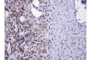 anti-Decapping Enzyme, Scavenger (DCPS) antibody