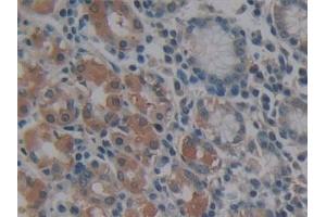 Detection of MMP14 in Human Stomach Tissue using Polyclonal Antibody to Matrix Metalloproteinase 14 (MMP14)