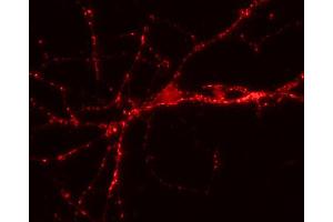 Immunofluorescence labeling of hippocampus neurons (dilution 1 : 500). (VAMP1, 2, 3 (AA 1-81) anticorps)
