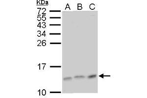 WB Image MP1 antibody detects MP1 protein by Western blot analysis.