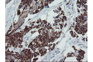 Image no. 2 for anti-Mitochondrial Ribosomal Protein S27 (MRPS27) (AA 151-414) antibody (ABIN1490963)