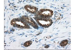 Immunohistochemical staining of paraffin-embedded Human Kidney tissue using anti-ACAT2 mouse monoclonal antibody. (ACAT2 anticorps)