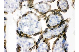 IHC analysis of PDPK1 using anti-PDPK1 antibody .