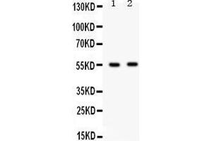 Observed bind size: 54KD (GABRB3 anticorps  (C-Term))