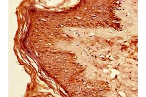 Immunohistochemistry of paraffin-embedded human skin tissue using ABIN7156631 at dilution of 1:100