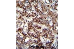 TRIM59 Antibody (N-term) (ABIN655580 and ABIN2845072) immunohistochemistry analysis in formalin fixed and paraffin embedded human liver tissue followed by peroxidase conjugation of the secondary antibody and DAB staining. (TRIM59 anticorps  (N-Term))