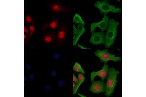 ABIN6264198 and ABIN6266655 staining Hela cells by IF/ICC. (PIAS3 anticorps  (N-Term))