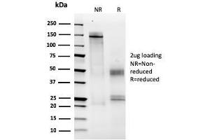 SDS-PAGE Analysis Purified MCM6 Mouse Monoclonal Antibody (MCM6/2999).
