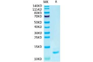 Human IL-15 on Tris-Bis PAGE under reduced condition. (IL-15 Protéine)