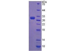 SDS-PAGE analysis of Chicken AMH Protein. (AMH Protéine)