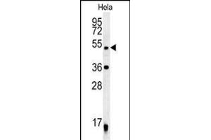 DDX47 Antibody (C-term) (ABIN652169 and ABIN2840575) western blot analysis in Hela cell line lysates (35 μg/lane).